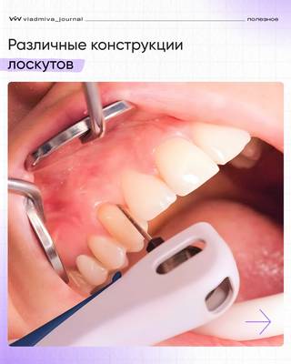 Maapima. Очистка корневых каналов без ошибок.